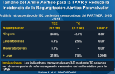 La Evaluación TC Transversal Mejora la Precisión del Tamaño del Anillo Aórtico para la TAVR y Reduce la Incidencia de la Regurgitación Aórtica Paravalvular