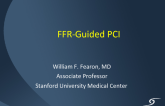 Procedural Guidance with FFR