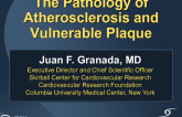 The Pathology of Atherosclerosis and Vulnerable Plaque