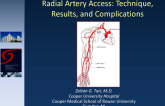 Radial Artery Access: Technique, Results, and Complications