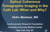 Optical Coherence Tomographic Imaging in the Cath Lab: When and Why