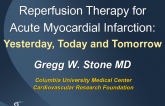 Reperfusion Therapy in STEMI: Guideline, Strategies, Pharmacology, and Stent Selection