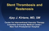 Stent Restenosis and Thrombosis: Etiology, Treatment, and Outcomes