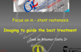Focus on In-Stent Restenosis: Imaging to Guide the Best Treatment