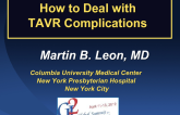 How to Deal with TAVR Complications
