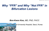 Why FFR and Why Not FFR in Bifurcation Lesions