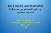 Drug-Eluting Balloon or Stent In Femoropopliteal Lesions: How Far Are We?