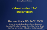 Valve-in-valve TAVI Implantation