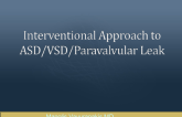 Interventional Approach to ASD/VSD/Paravalvular Leak