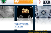 TF Braile TAVR System: Taped Case, Design and Function, and Clinical Outcomes