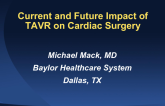 Cardiac Surgery