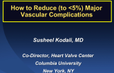How to Reduce (to Less Than 5%) Major Vascula Complications