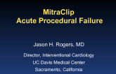 Case Study 1: An Acute Procedural MitraClip Failure