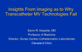 Insights from Imaging as to Why Transcatheter MV Technologies Fail