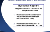 Case Study 1: Discrepancy Between Imaging Studies for MR