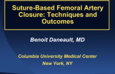 Suture-Based Femoral Artery Closure: Techniques and Outcomes(2)