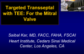 Targeted Transseptal with TEE: For the Mitral Valve