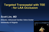 Targeted Transseptal with TEE: For LAA Occlusion