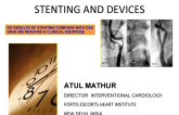 Evidence for Carotid Stenting and Devices