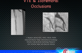 VTE and Iliofemoral Occlusions