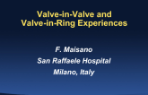 Valve-in-Valve and Valve-in-Ring Experiences