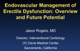 Endovascular Management of Erectile Dysfunction: Overview and Future Potential