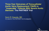 PARTNER Cohort B Three Year: Clinical and Echocardiographic Outcomes from a Prospective, Randomized Trial of Transcatheter Aortic Valve Replacement in “Inoperable” Patients