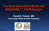 The Next-Generation Engager TAVR System