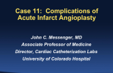 Cases 11 and 12: Complications of Acute Infarct Angioplasty
