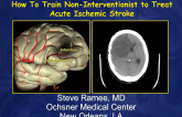 How to Train Non-Neurointerventionalists to Treat Acute Ischemic Stroke