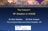 The Future? Radiofrequency Catheter Septal Ablation for HCM