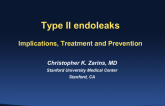 Type II Endoleaks: Implications, Treatment, and Prevention