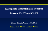 Retrograde Dissection and Reentry: Reverse CART and CART