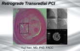 Transradial Retrograde Approach for a Chronic Total Occlusion