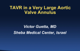 TAVR in a Very Large Aortic Valve Annulus