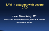 TAVR in a Patient with Severe CAD