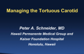 Managing the Tortuous Carotid