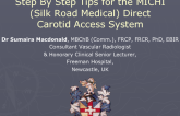 Step-by-Step Tips for the MICHI (Silk Road Medical) Direct Carotid Access System