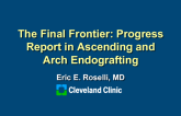 The Final Frontier: Progress Report in Ascending Aorta and Arch Endografting