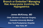 Branch or Embolize? Managing Iliac Aneurysms Involving the Hypogastrics