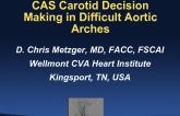 CAS Decision Making in Difficult Aortic Arches