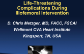 Case 3: During an Iliofemoral Intervention