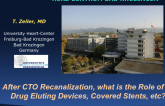 After CTO Recanalization, What Is the Role of Drug-Eluting Devices, Covered Stents, Etc?