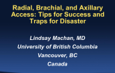 Radial, Brachial, and Axillary Access: Tips for Success and Traps for Disaster