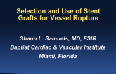 Selection and Use of Stent Grafts for Vessel Rupture