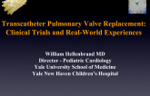 Transcatheter Pulmonary Valve Replacement: Clinical Trials and Real-world Experiences
