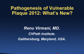 Pathogenesis of Vulnerable Plaque 2012: What's New?