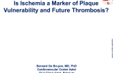 Is Ischemia a Marker of Plaque Vulnerability and Future Thrombosis?