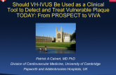 Should VH-IVUS Be Used as a Clinical Tool to Detect and Treat Vulnerable Plaque TODAY: From PROSPECT to VIVA