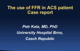 Case 4: FFR in ACS